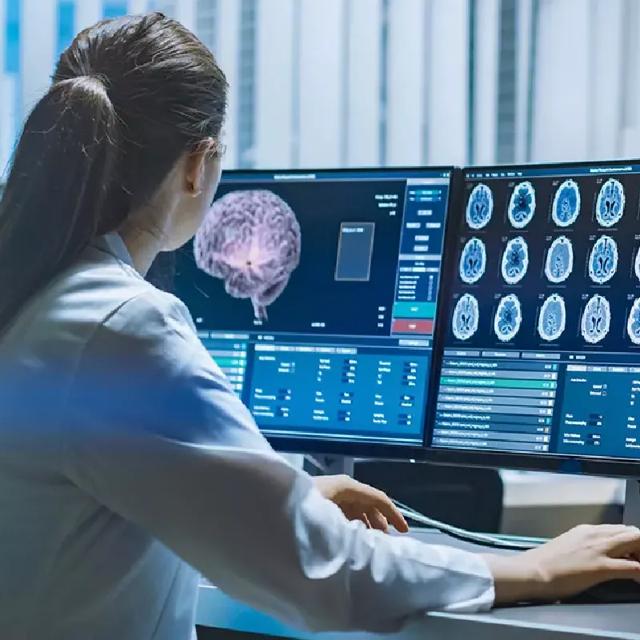 carestream customer story xactly